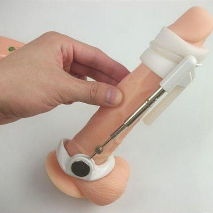 An extender helps to enlarge the penis without creams
